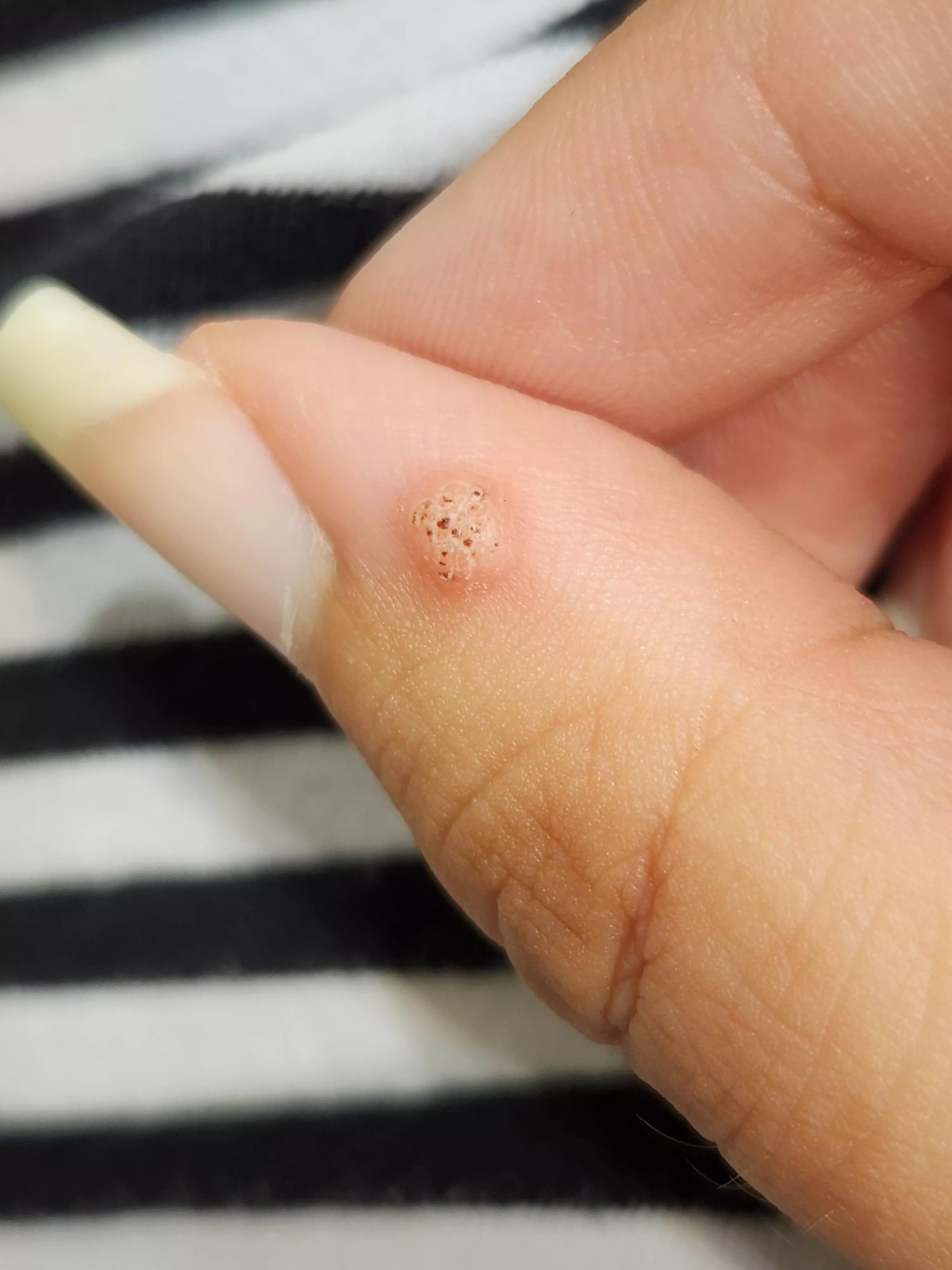 Feel like I should just take some nail clippers to this thing.  posted by InvisibleScorpion7