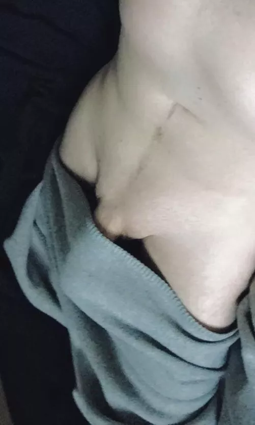 Blanket bulge 24 by evermac