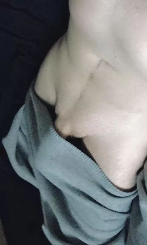 Blanket bulge 24 posted by evermac