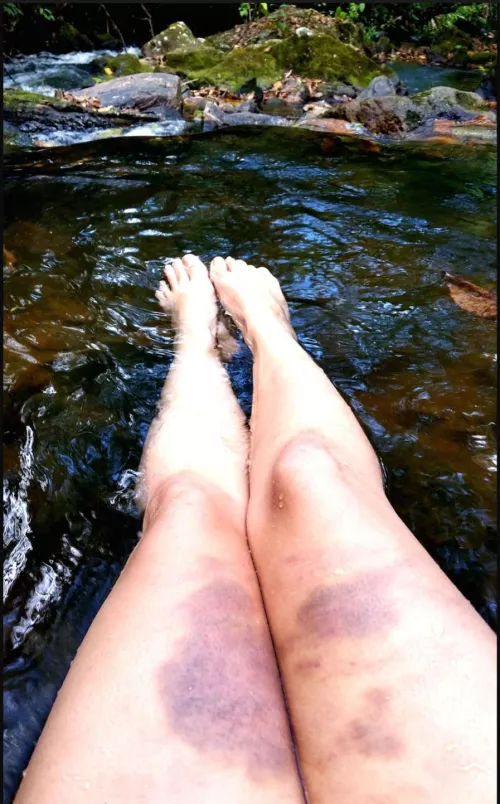 Purple marks by Key-Pangolin-9617