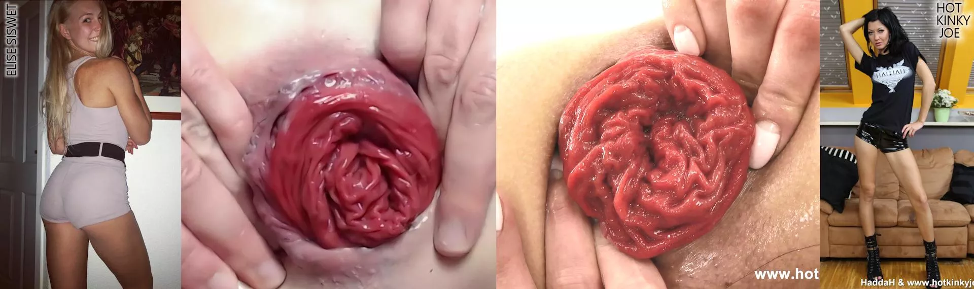 Choose your juicy rektal 🌹 ! posted by Destined2SuckAsshole