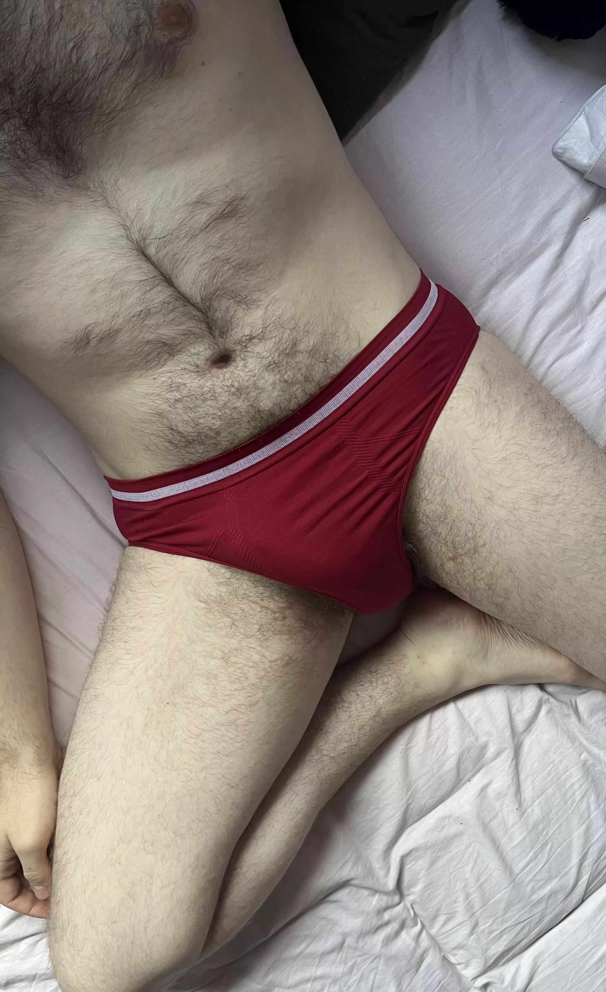 Even hairier when you take them off  posted by Charming-Coat-8705