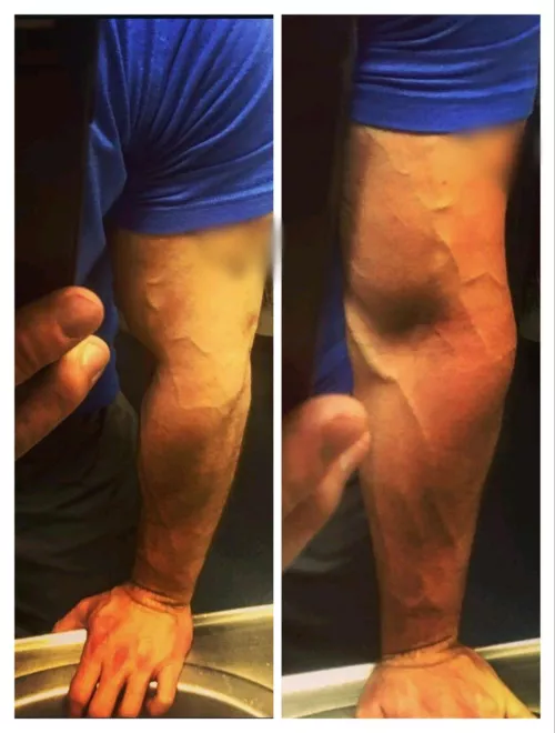 Hopefully a little bicep is welcome  by Who_dis_091989