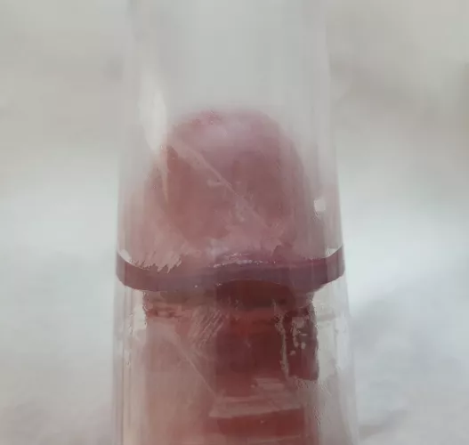 Tapering tube, frenulum touching all around. Should I get a bigger tube? by GlenGrunt