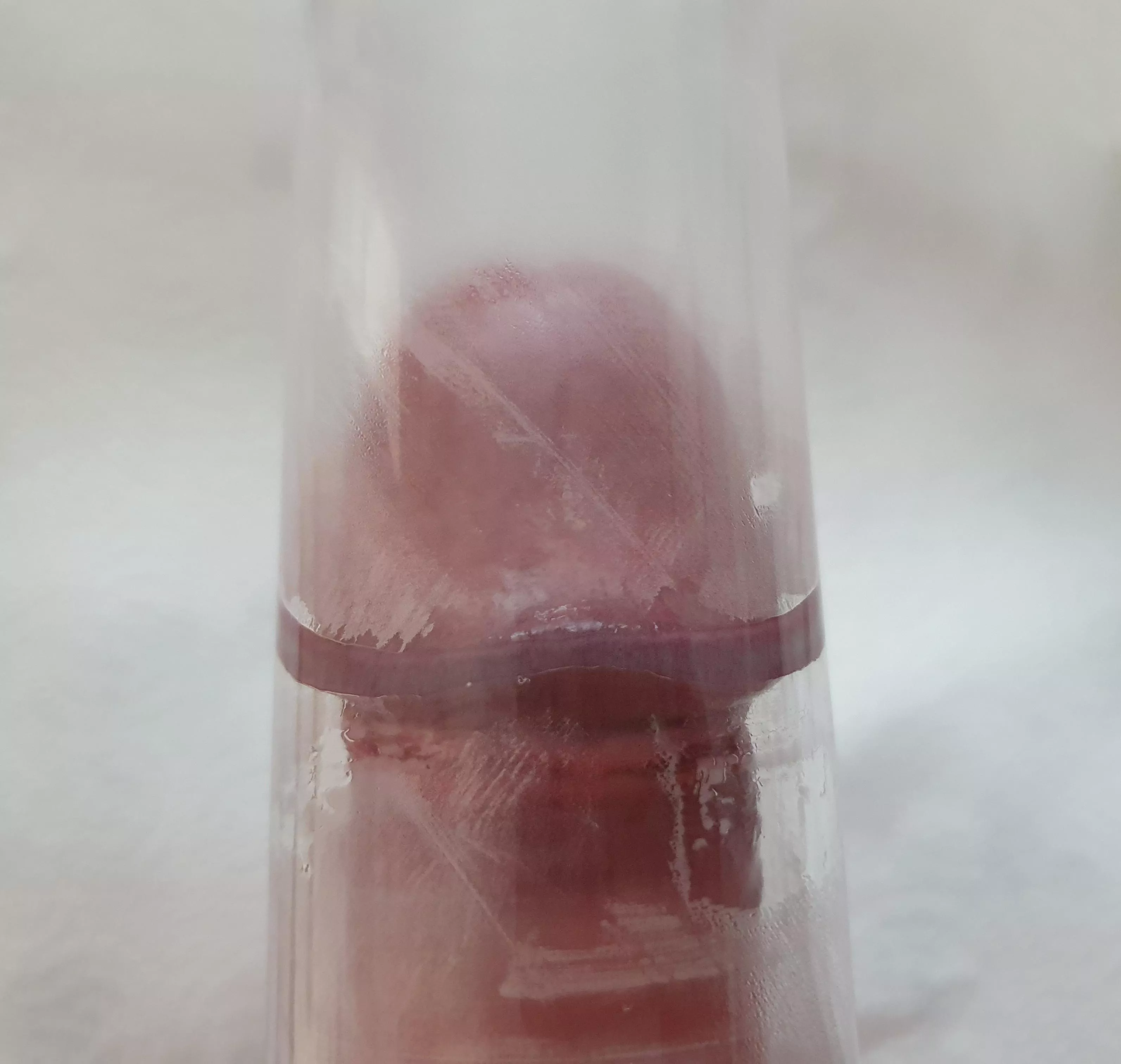 Tapering tube, frenulum touching all around. Should I get a bigger tube? posted by GlenGrunt