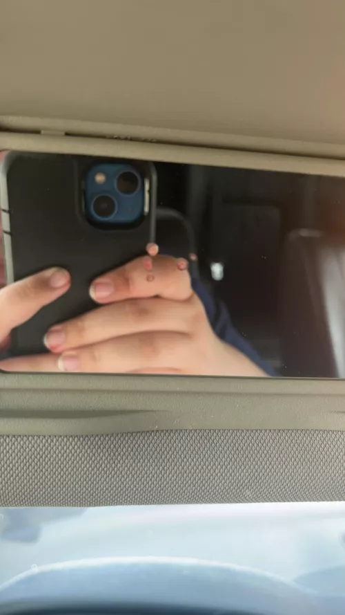 Aftermath of popping a forehead cyst in the car  by Public-Brain2164