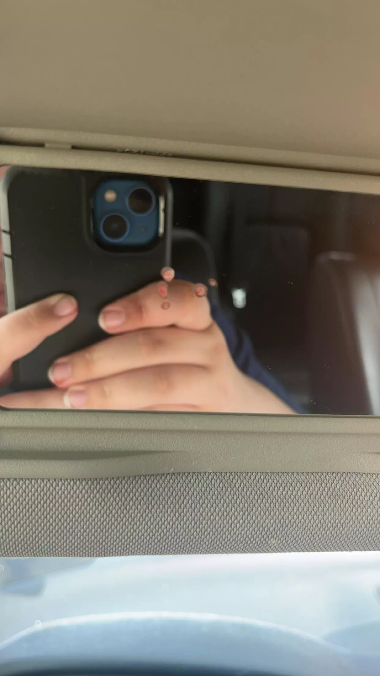 Aftermath of popping a forehead cyst in the car  posted by Public-Brain2164