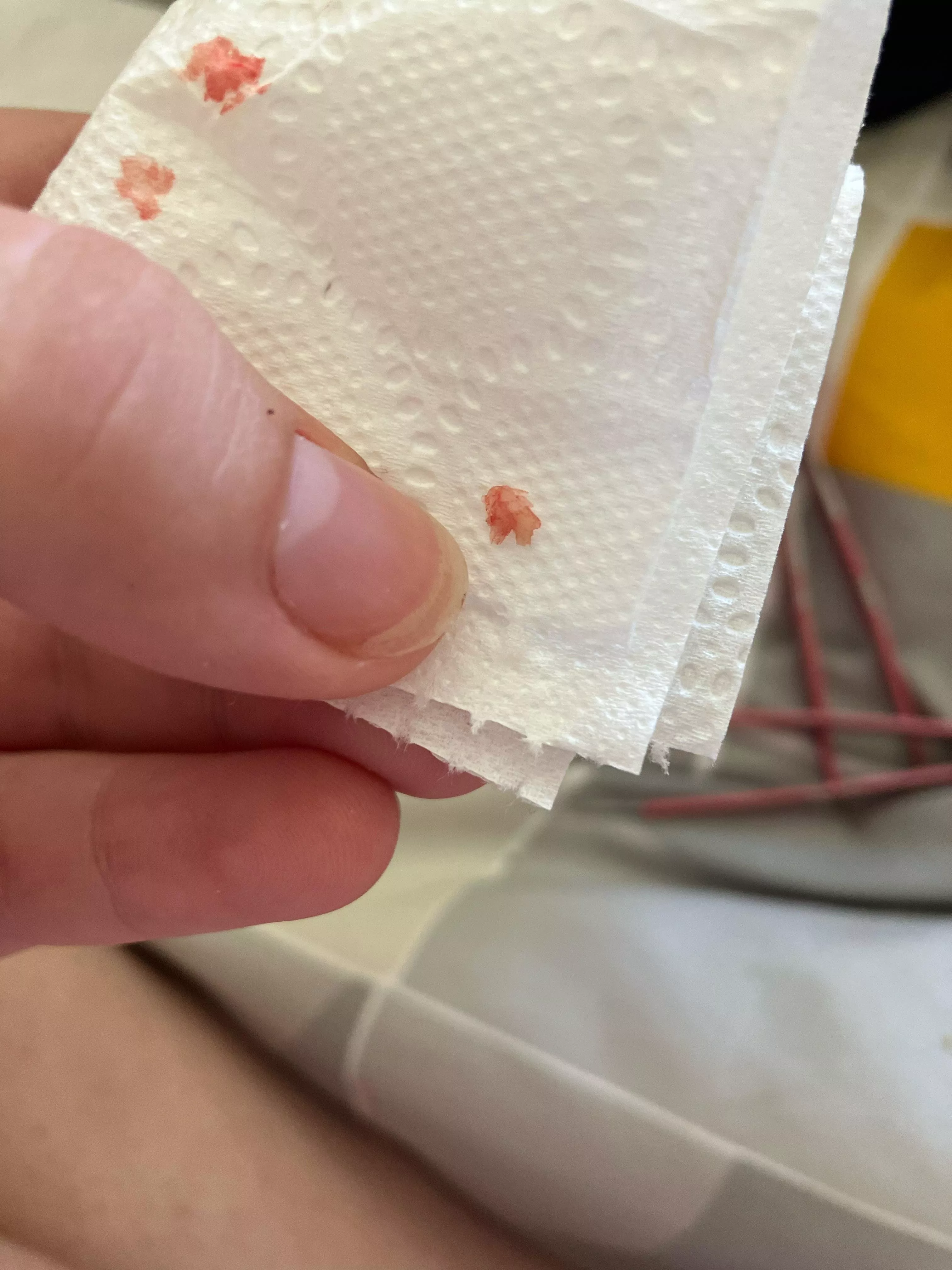 Reoccurring Ingrown toenail.  posted by ImmediateIce675