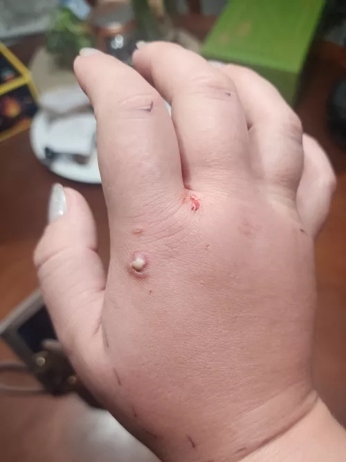 Want to pop it SO BAD by thatisnot_myname