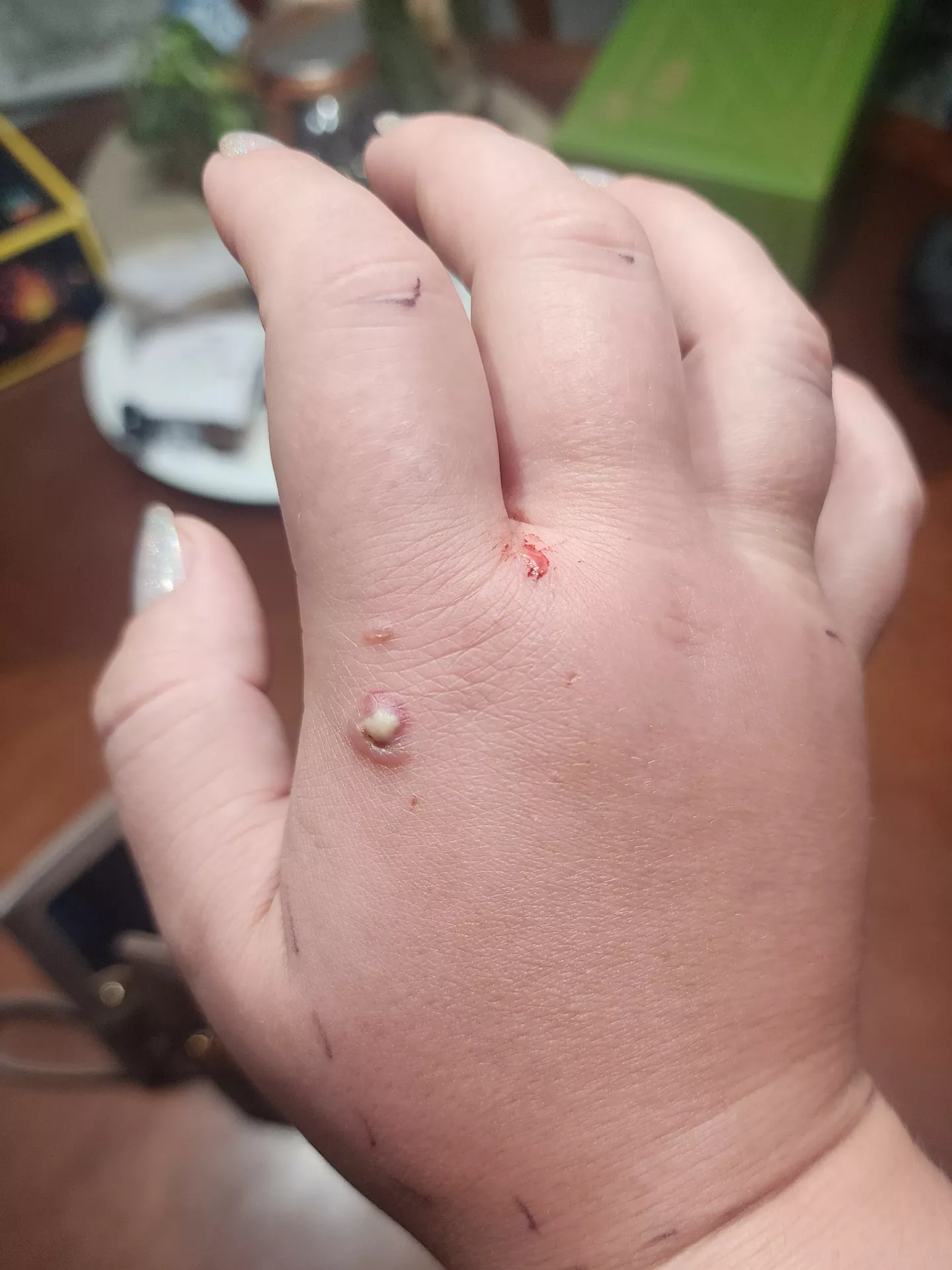 Want to pop it SO BAD posted by thatisnot_myname