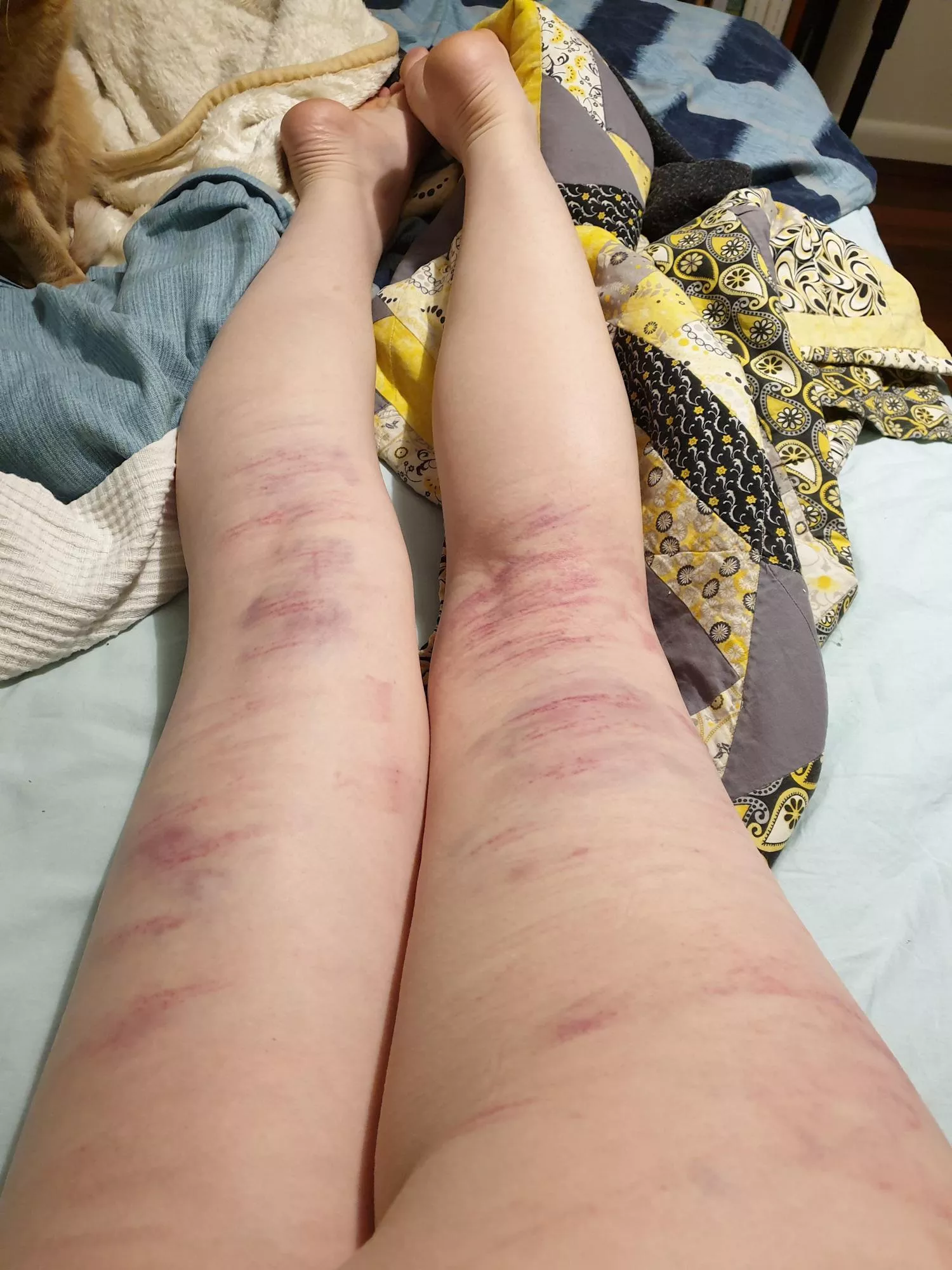 from my latest beating posted by itsjustallergies0