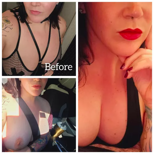 She asked if she should get her lips filled again before her implants in November by DatBassTho5