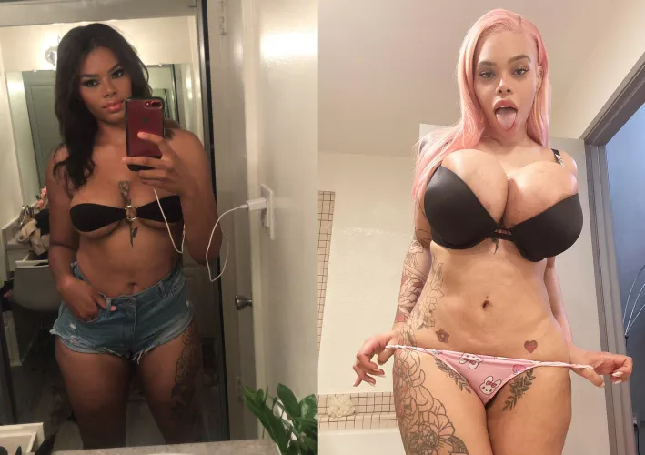 every woman looks so much better with implants by Top-Story391