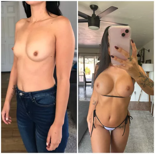 my 700 cc tits look so much better by wild_booty_princess