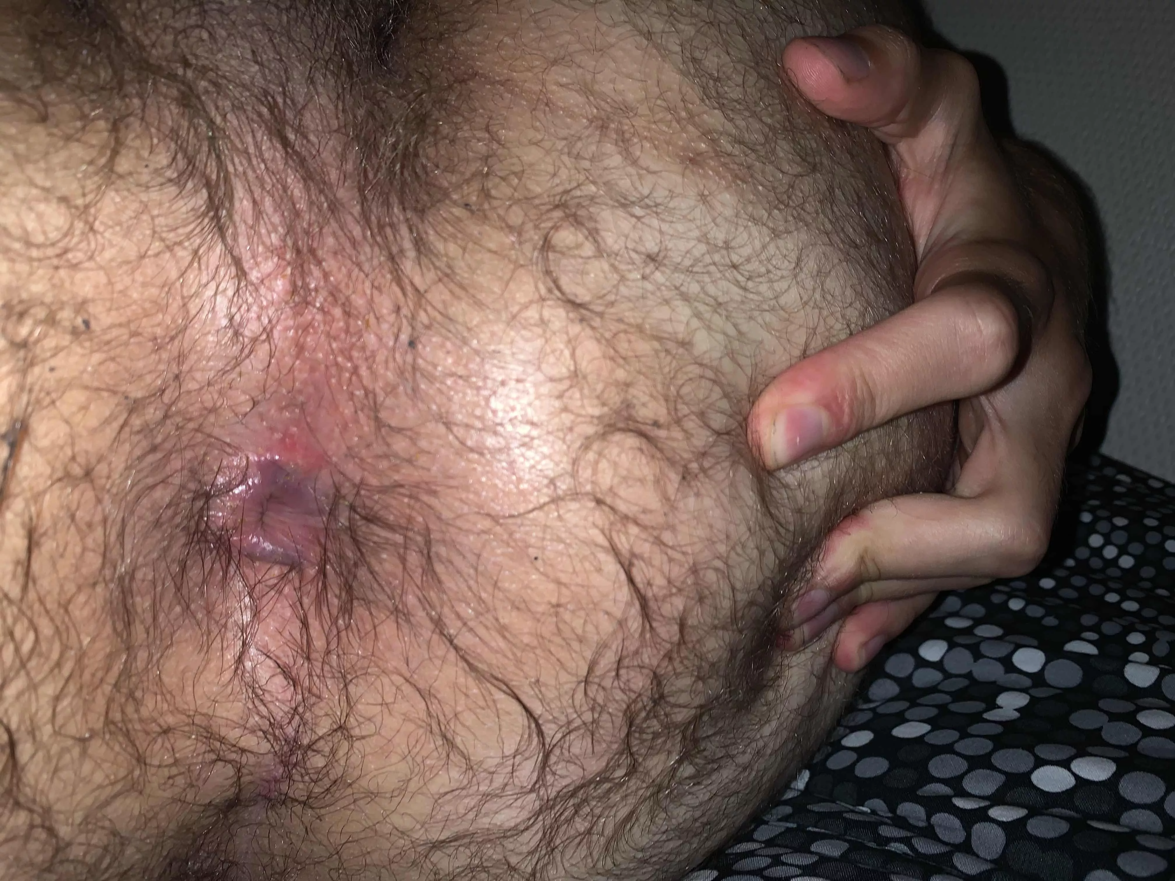Fuck my hairy morning ass! posted by 96swill