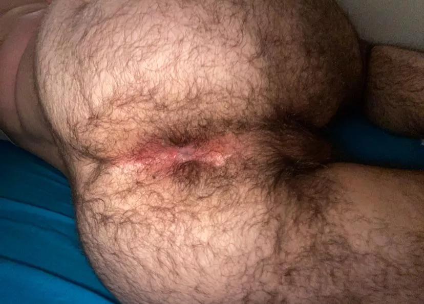 My hairy ass. What do you think? posted by ardenir98