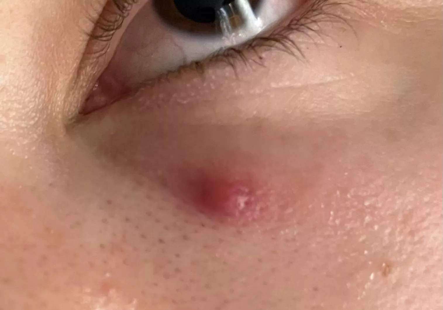 Forbidden under eye pop posted by Zealousideal_Gur_524