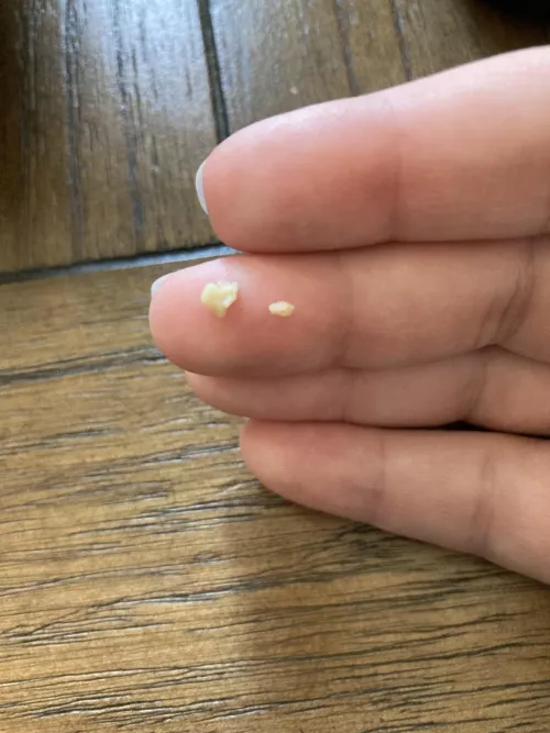 Coughed these up today by WildForestFerret