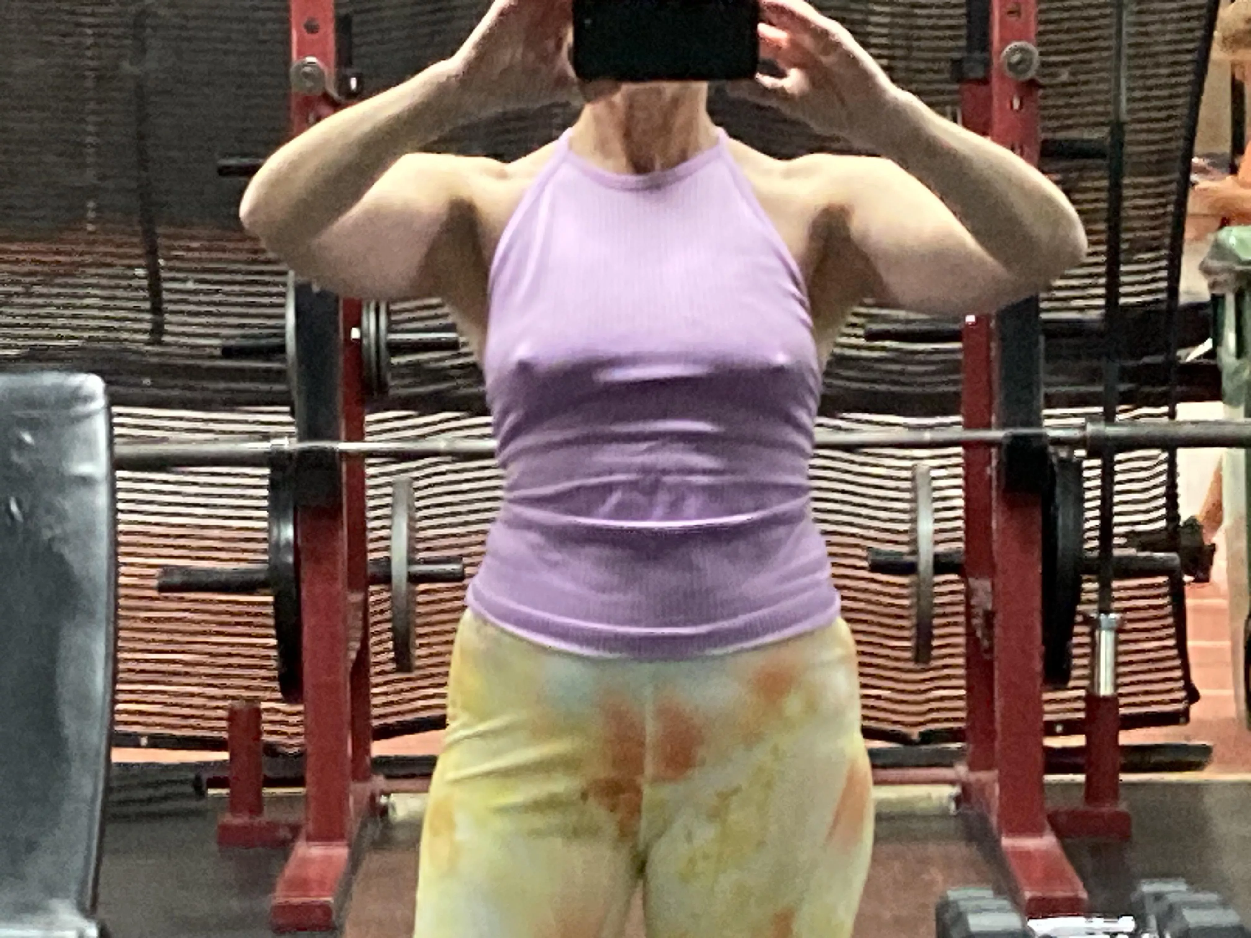 Yes, people do stare.  posted by Juicy_gypsy