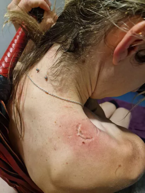 Bite play is so sex  by yooll3873