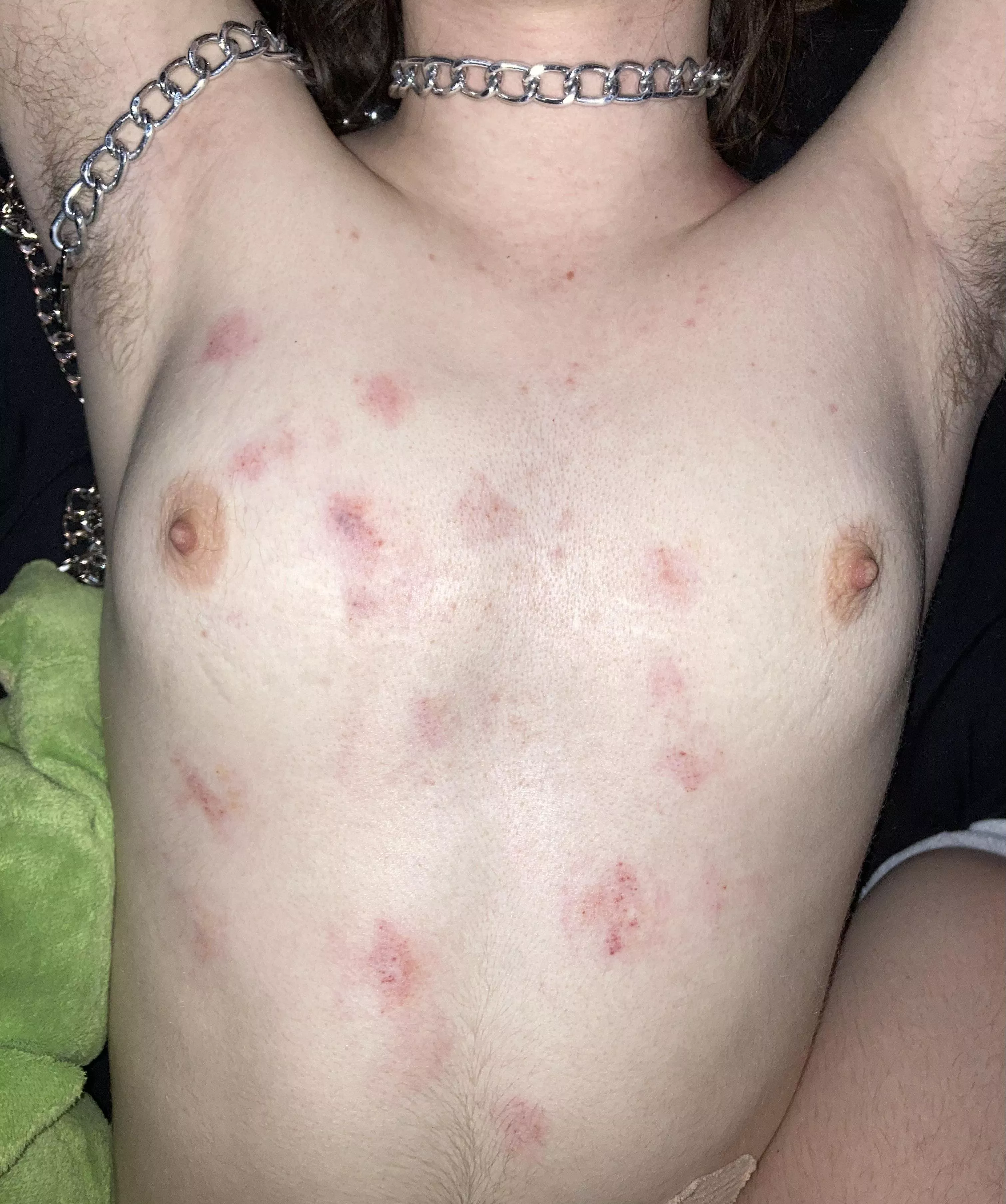 do you like giving hickeys? posted by coolestinoneland