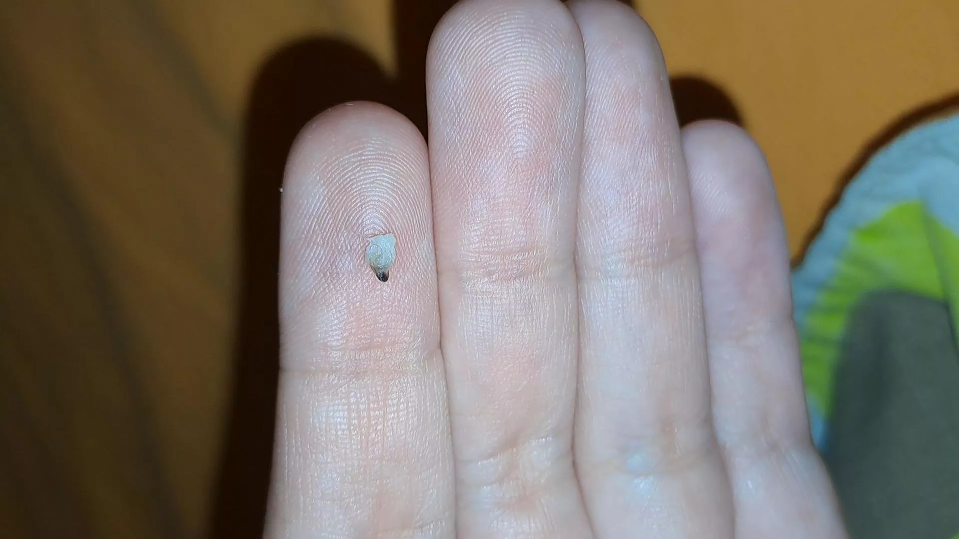 A black head I extracted  posted by Comfortable_Turn4963