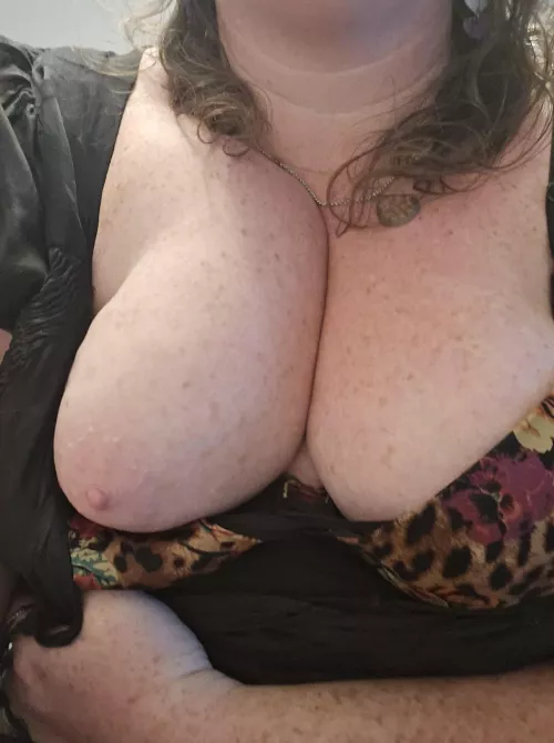 Freckle fans wanted  by MostlyJustFreckles