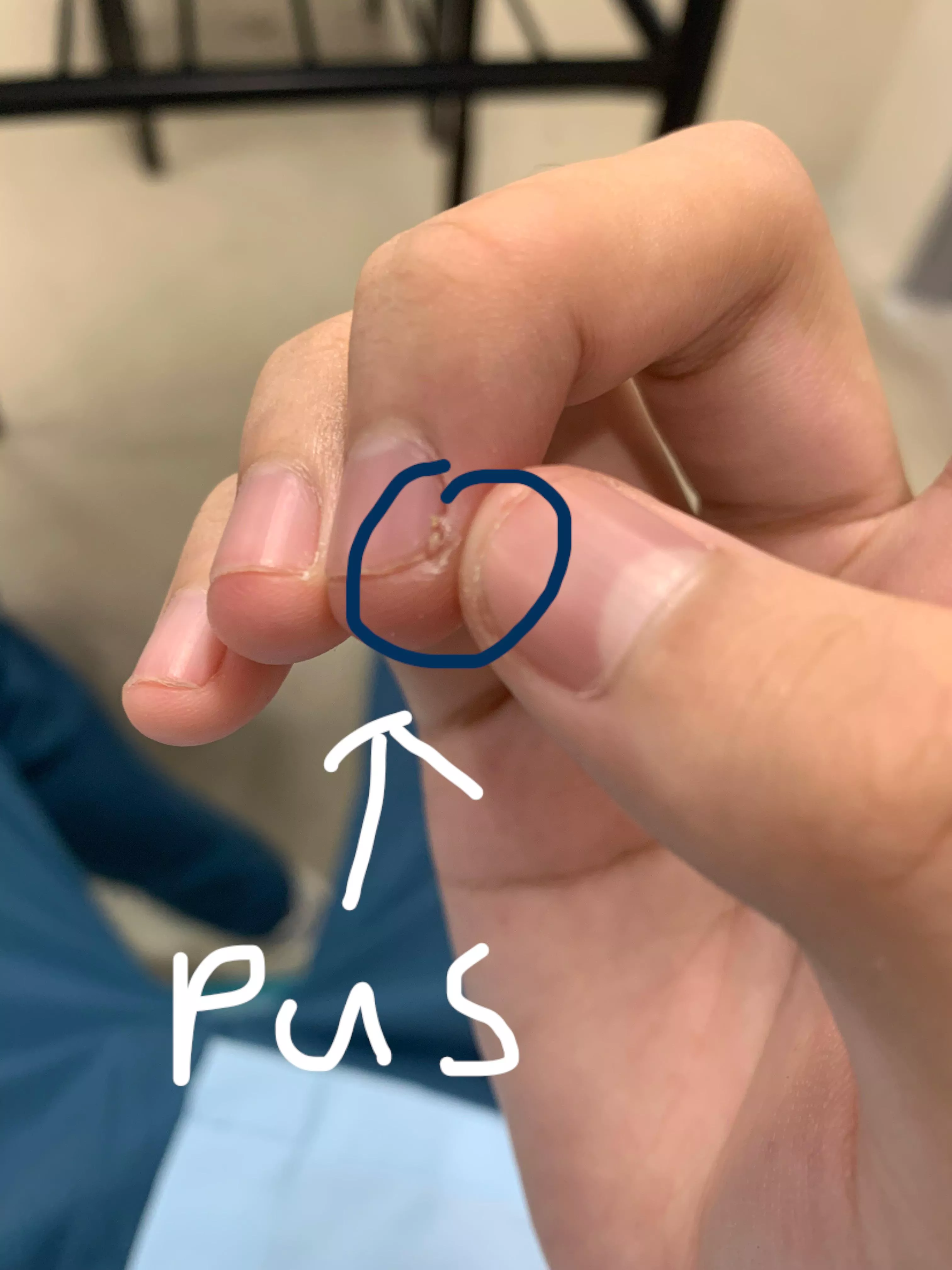 Long time lurker but finally got an opportunity to post in here when I popped this little bugger here. posted by Upset_Fan_6126