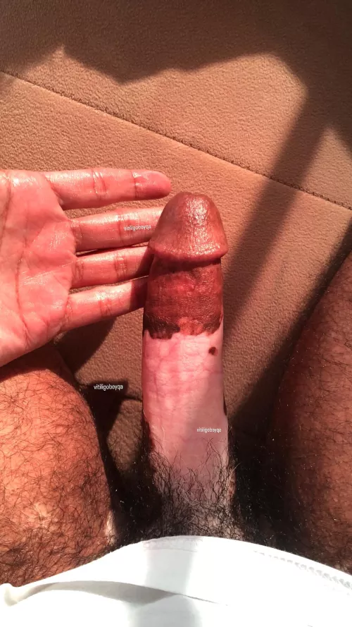 (27) Good morning 🌅  by vitiligoboyqa