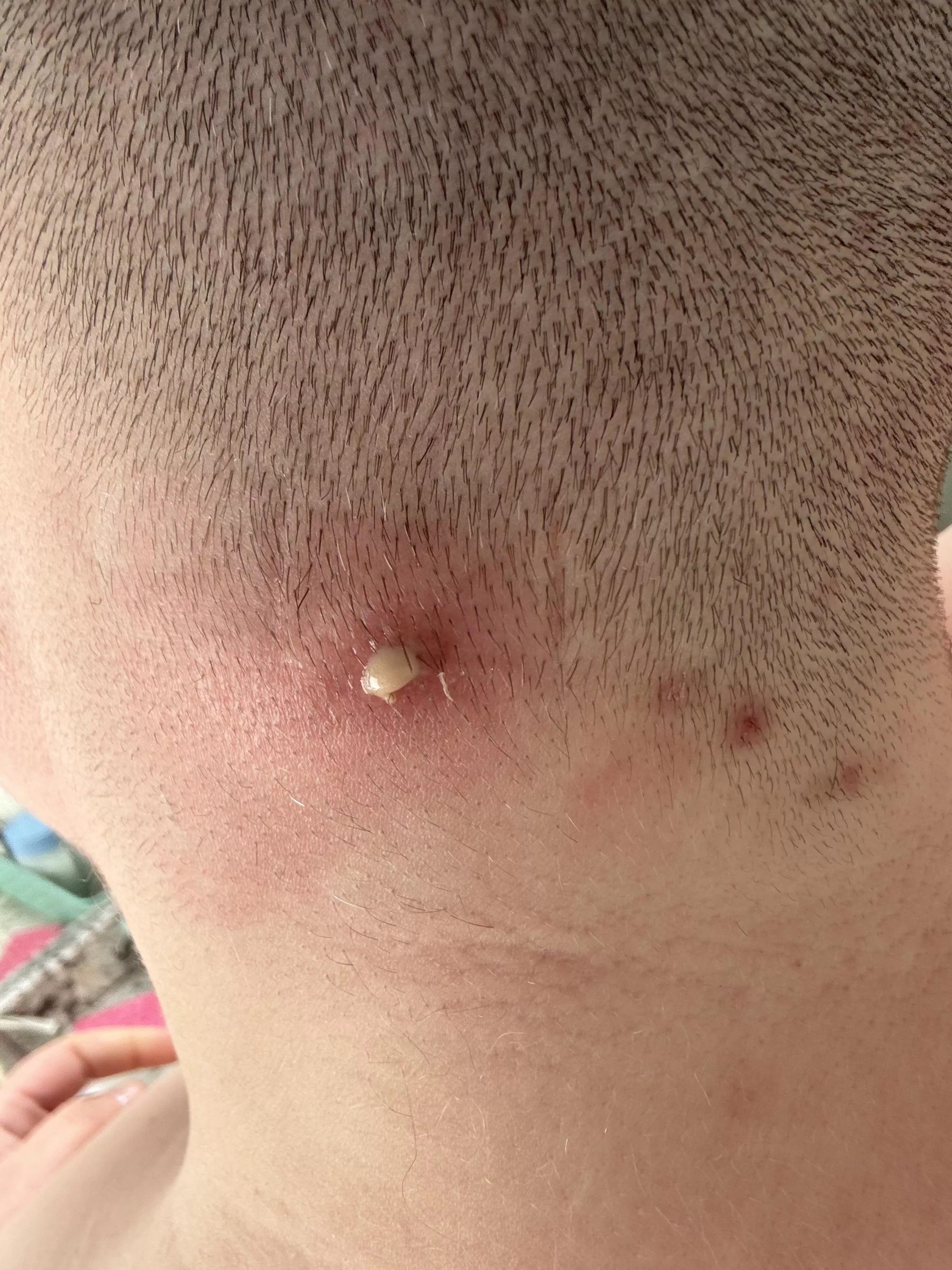 Neck planet update: it’s beginning posted by ostodon