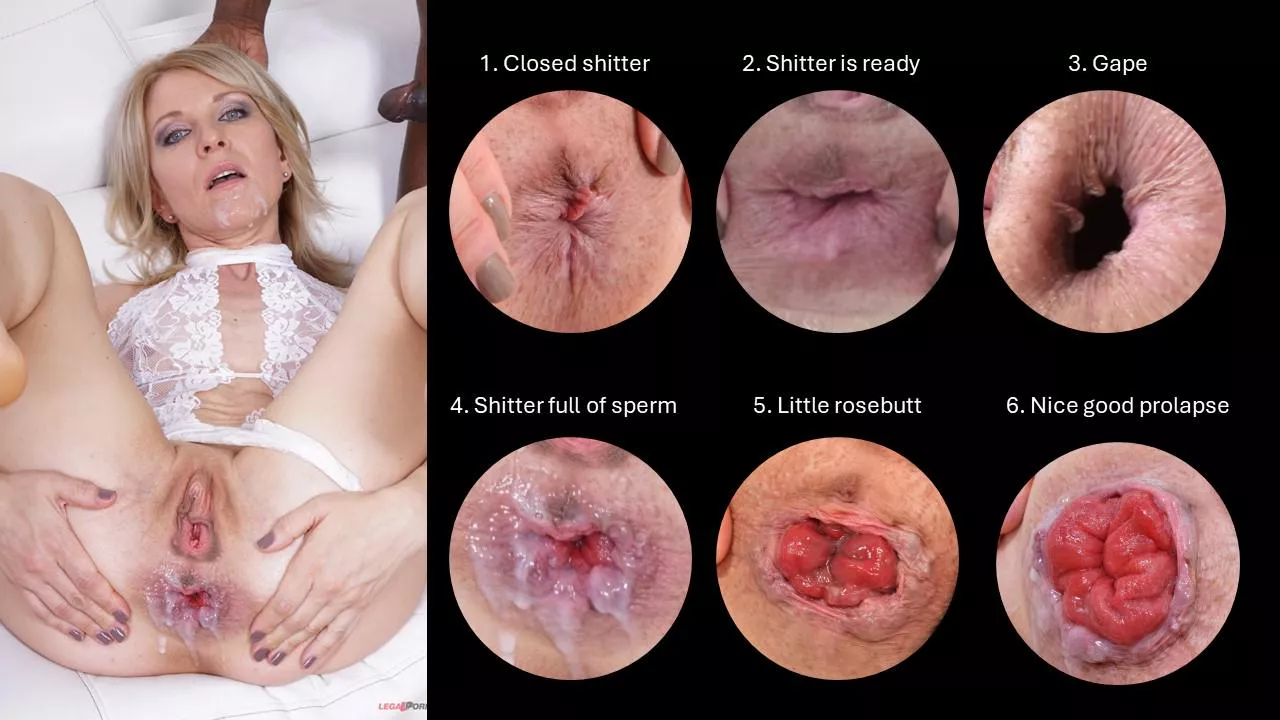 Which state of Sindy Rose asshole is your favourite?  posted by Emergency-Pea-5448