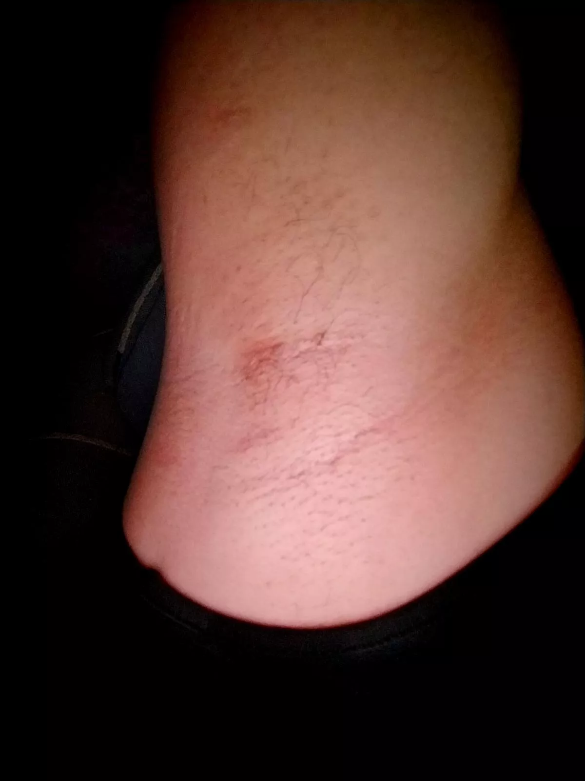 moisturize my skin with your tongue  posted by AlmendraPonce