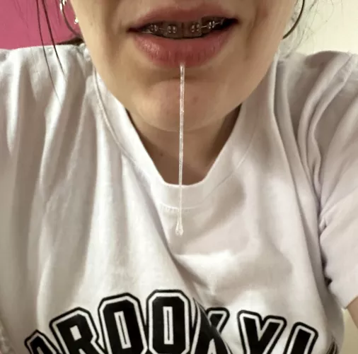 Braces and drool, isn't that the best combination? by RebecaClarkBigAss