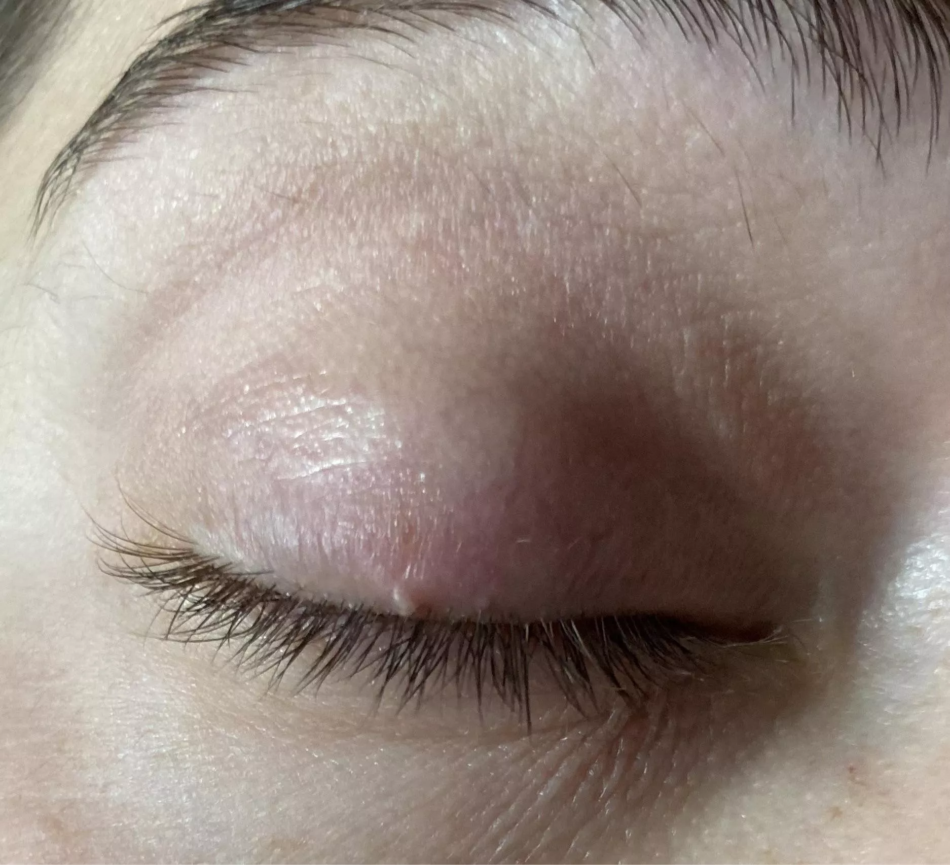 Forbidden eye lid pop posted by S_Wicka