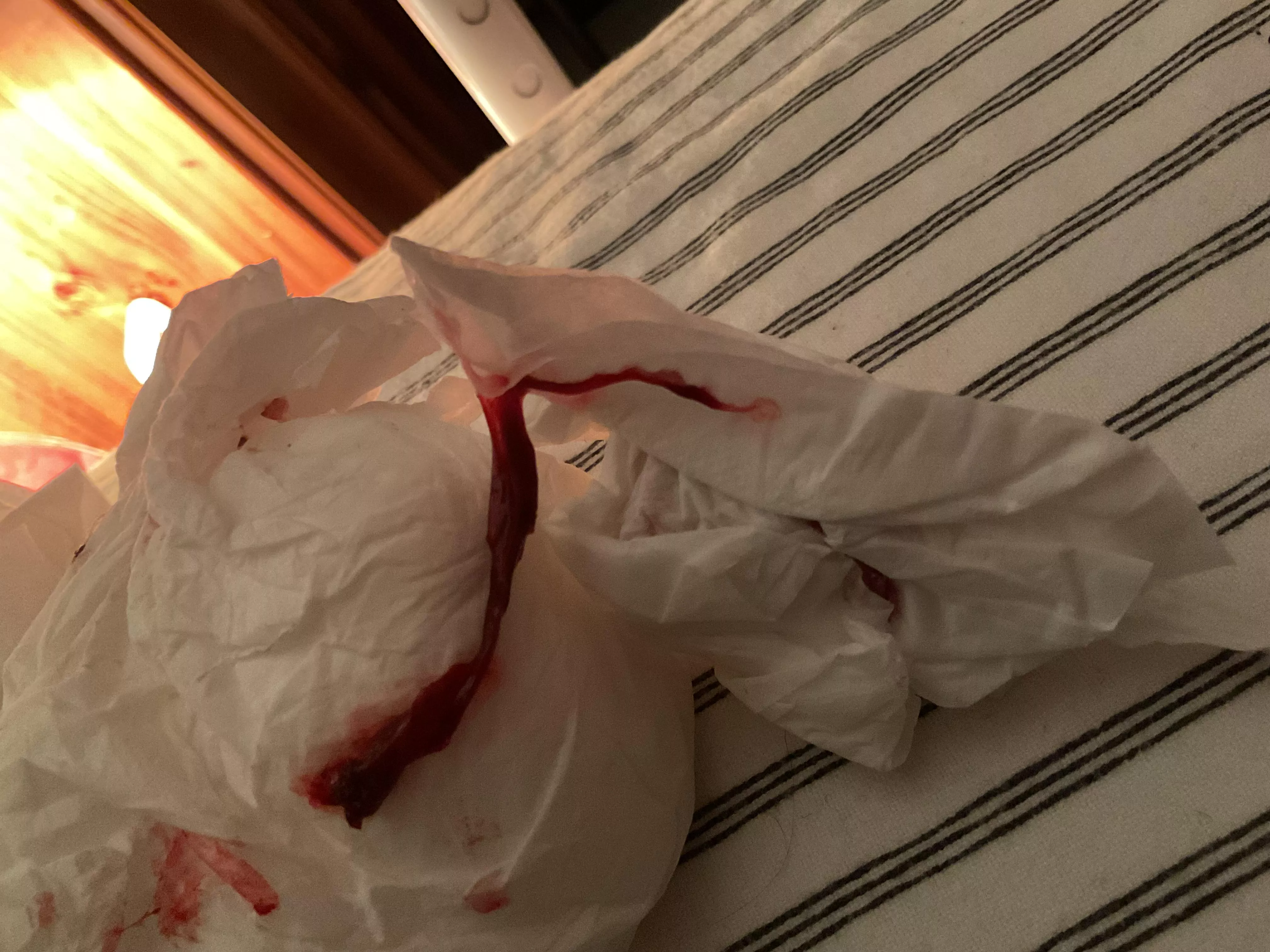 Just pulled this out of my nose posted by Spfromau