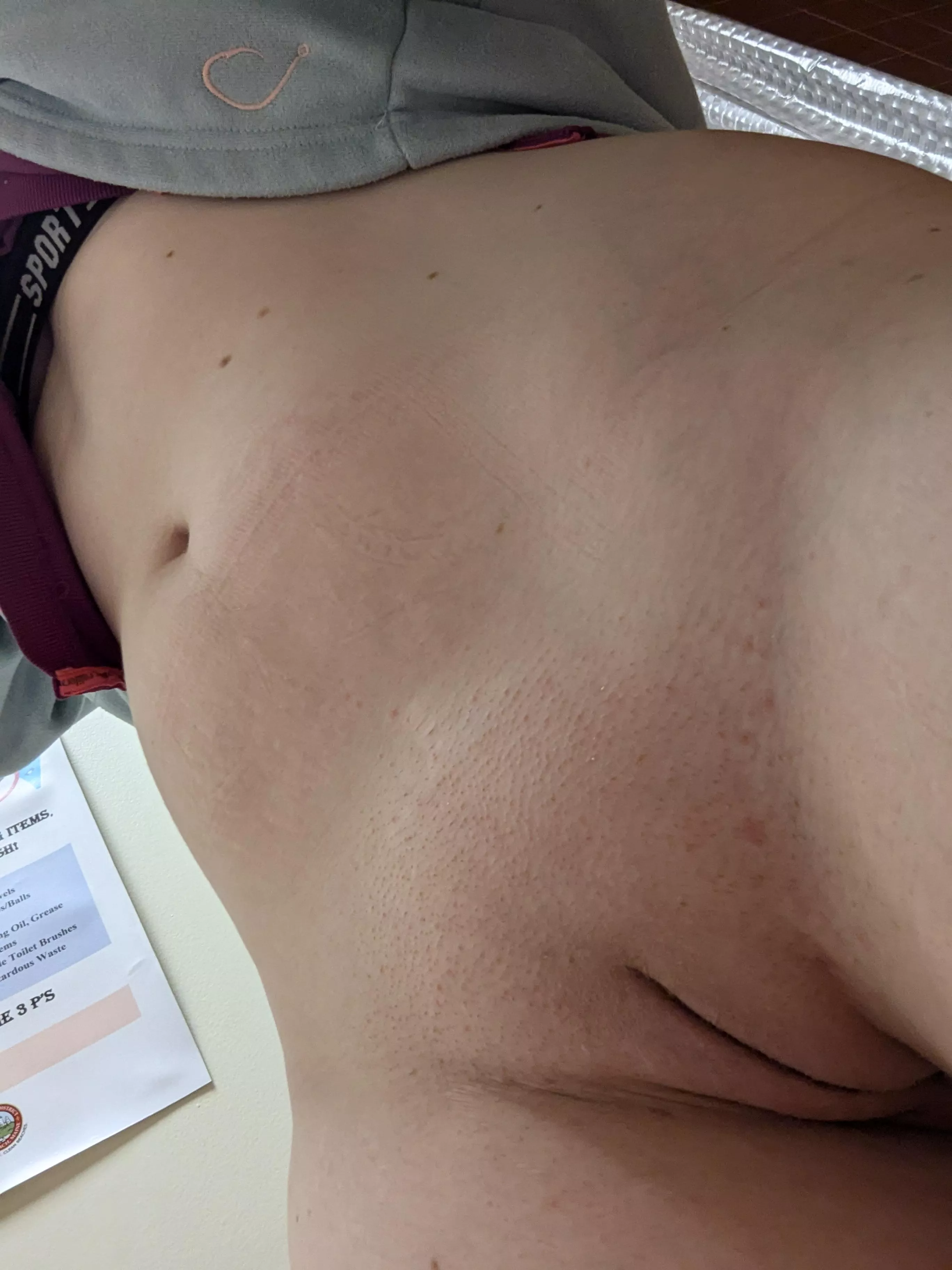 My mound view  posted by SweetRedRuby_