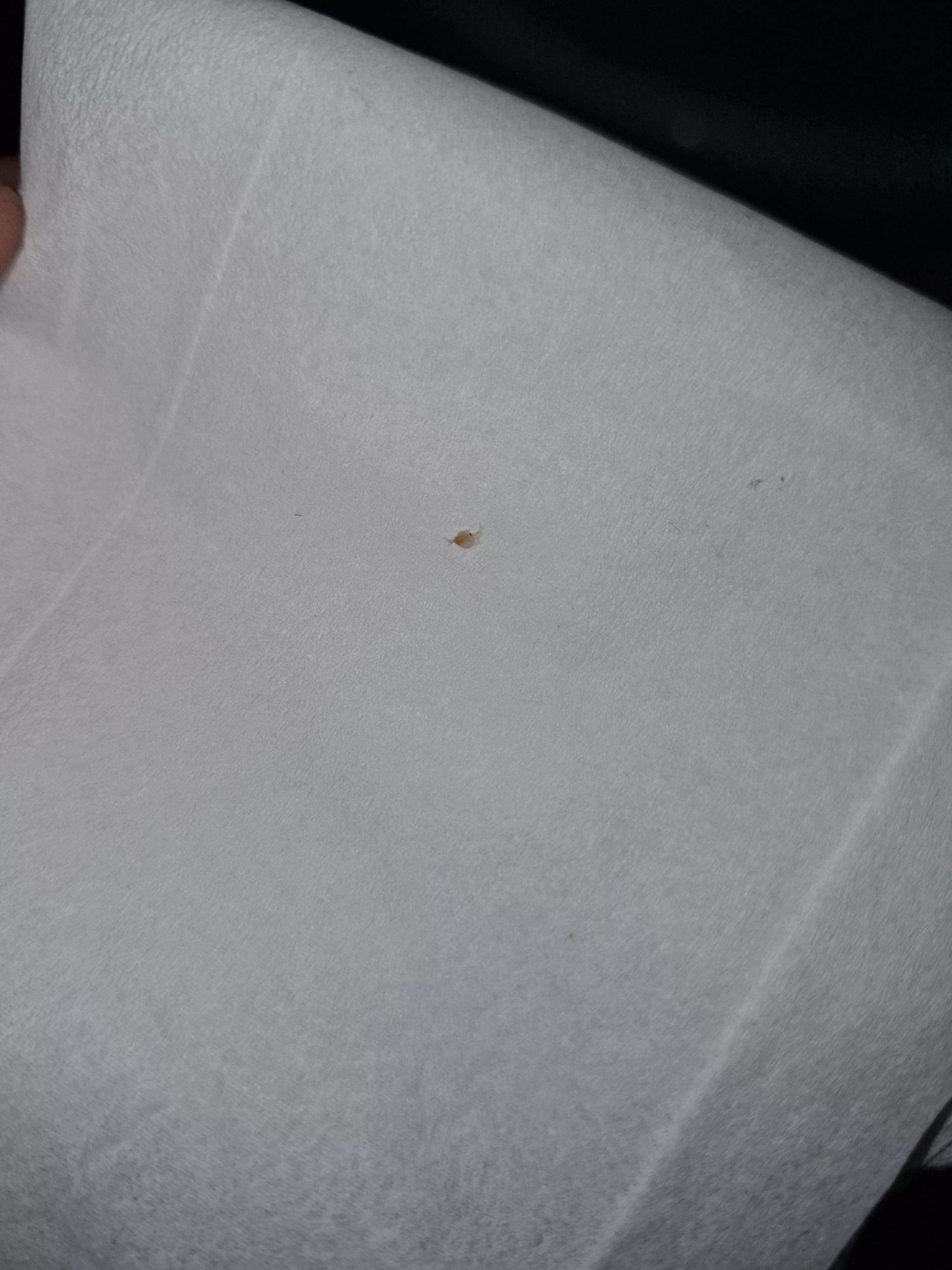 Popped this out of my stomach, felt like an insect bite but it's firm posted by CorporateDoggooo