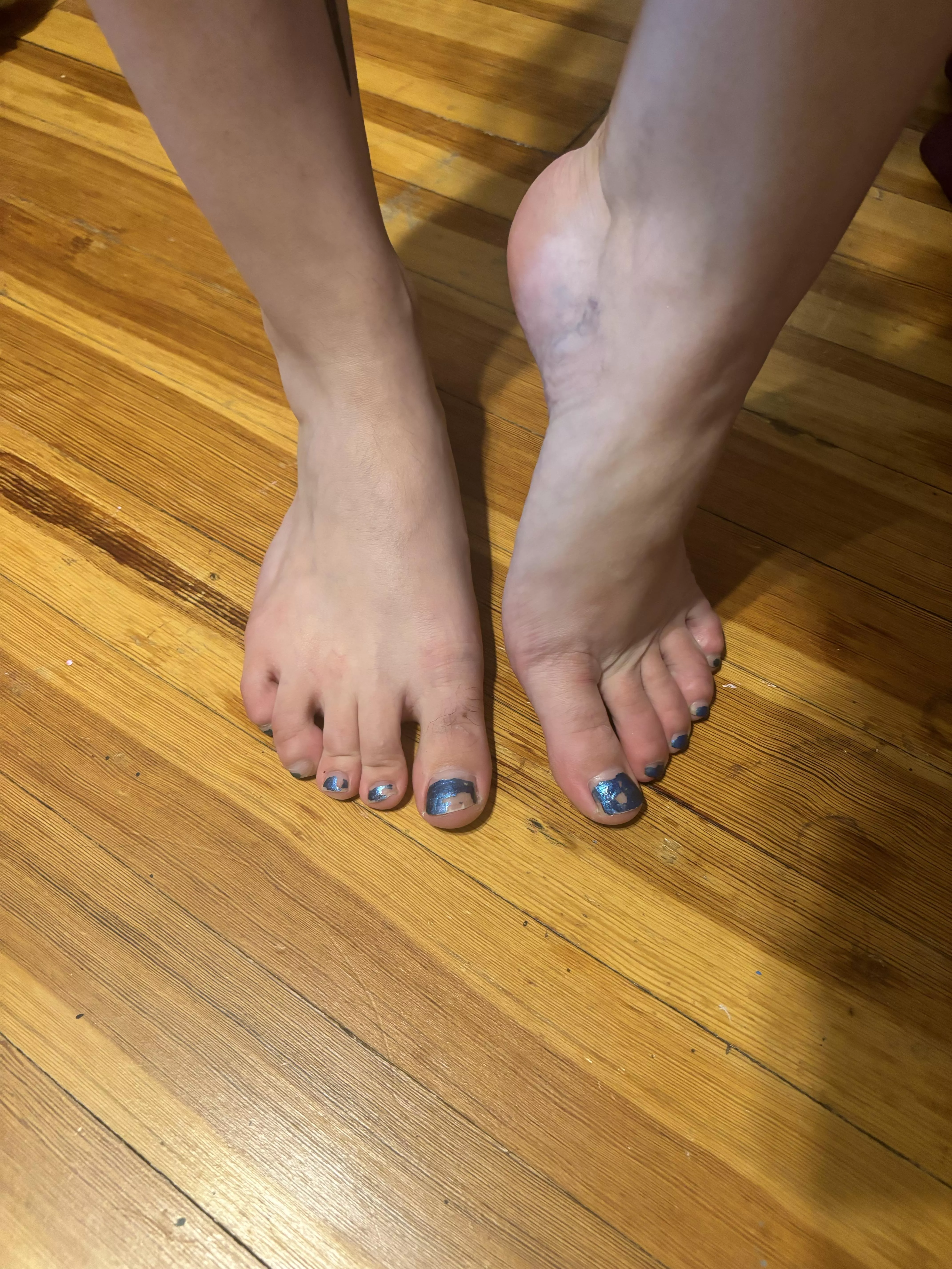 Chipped blue toes posted by sirenskiss3