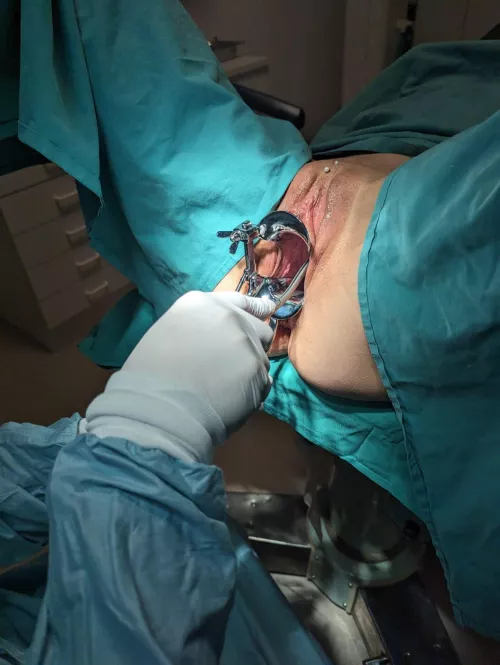 Dilator fun by kinkndirty