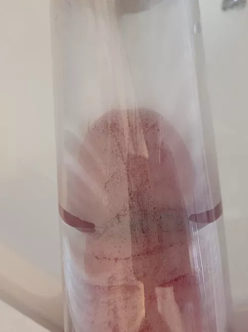 Corona and head swell way more than shaft when pumping. Is this normal?? by GlenGrunt