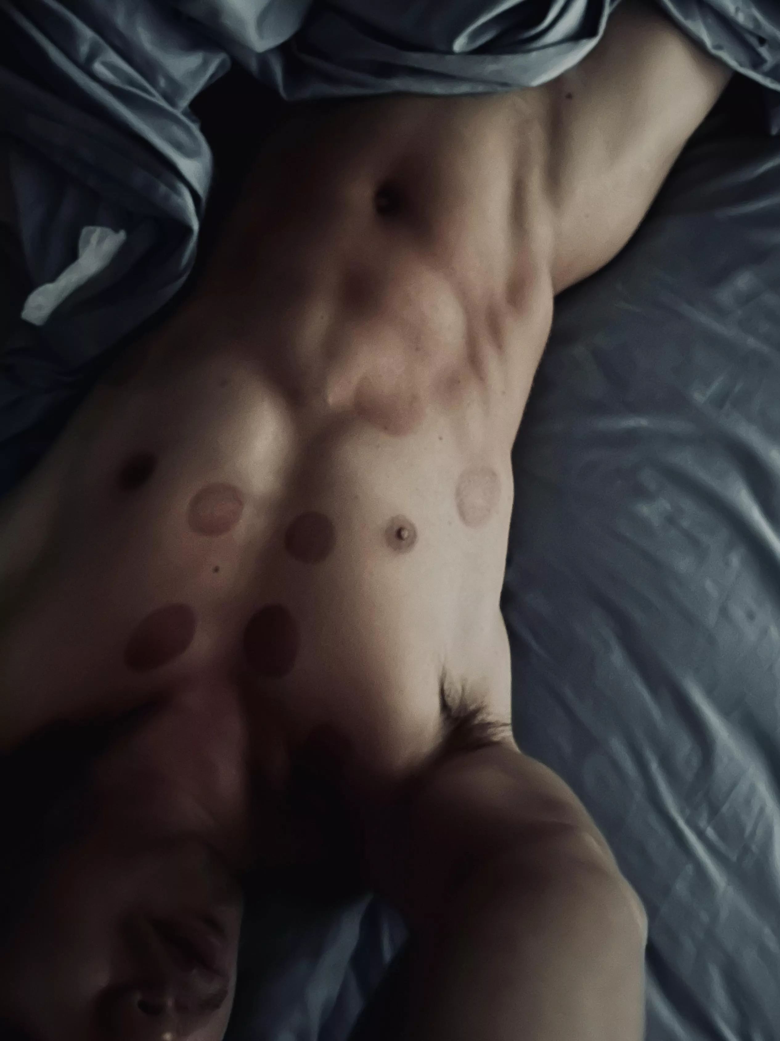 First post here. Don’t mind the hickies. posted by emj-again