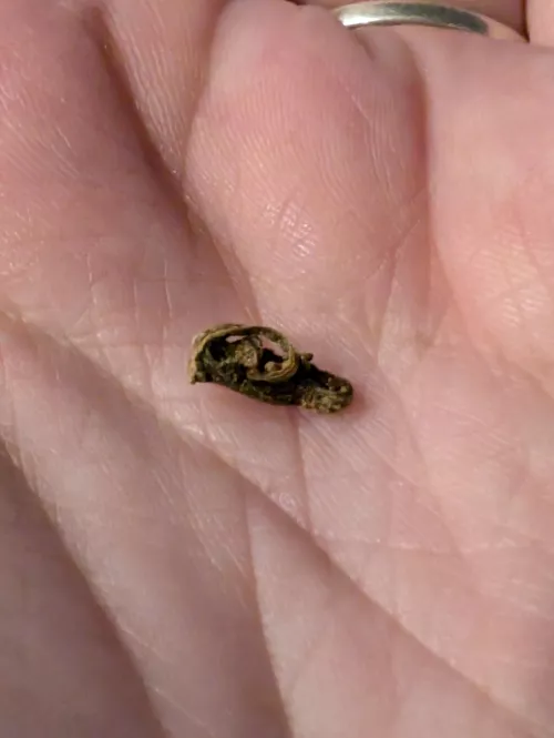 Ingrown hairs run in my family, I thought because I was blonde I was exempt, I was not.  by lysdexicgirl0705