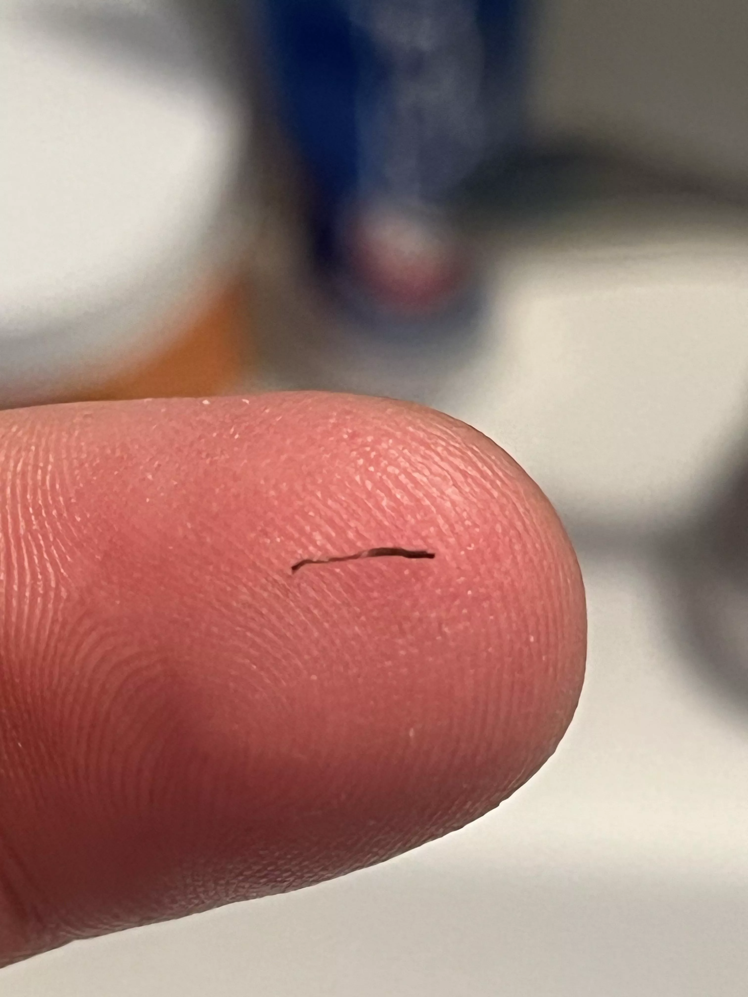 Just pulled this weird hair out of my beard  posted by depressed-onion7567