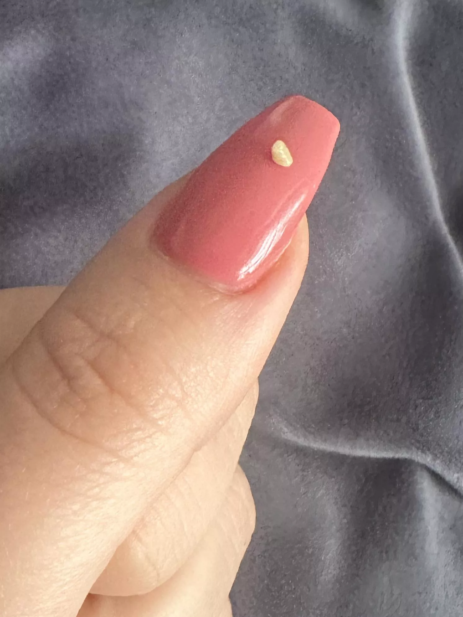 The tonsil stone but I am tonsil less? posted by Fun_Baby_8537