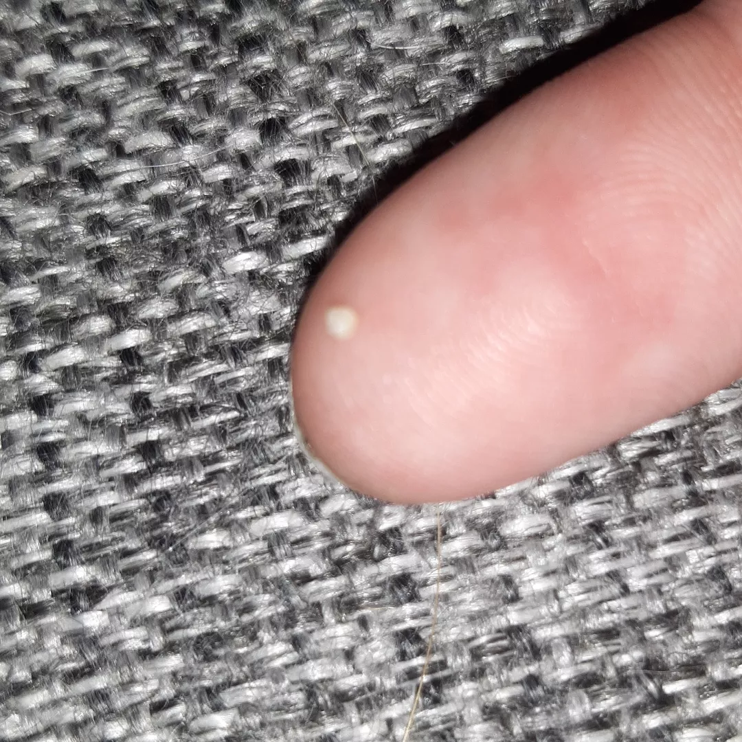 Squeezed out of pubic area posted by timbbanen