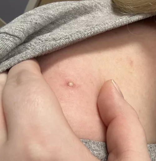 The prettiest white head  by CreepyConsequence_