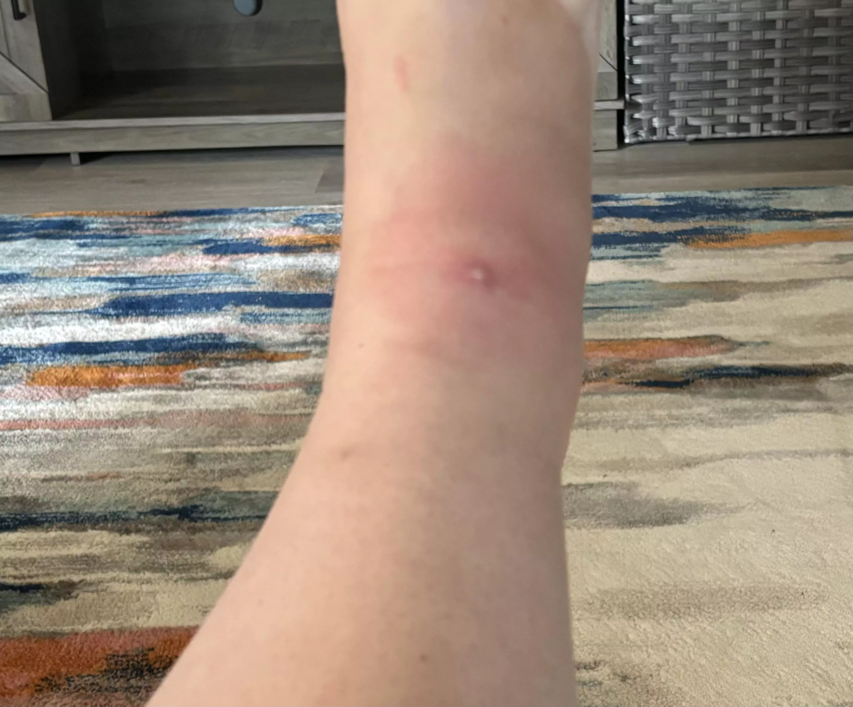 An ant got me and I’m sad it’s a forbidden pop posted by definitelygrouchy