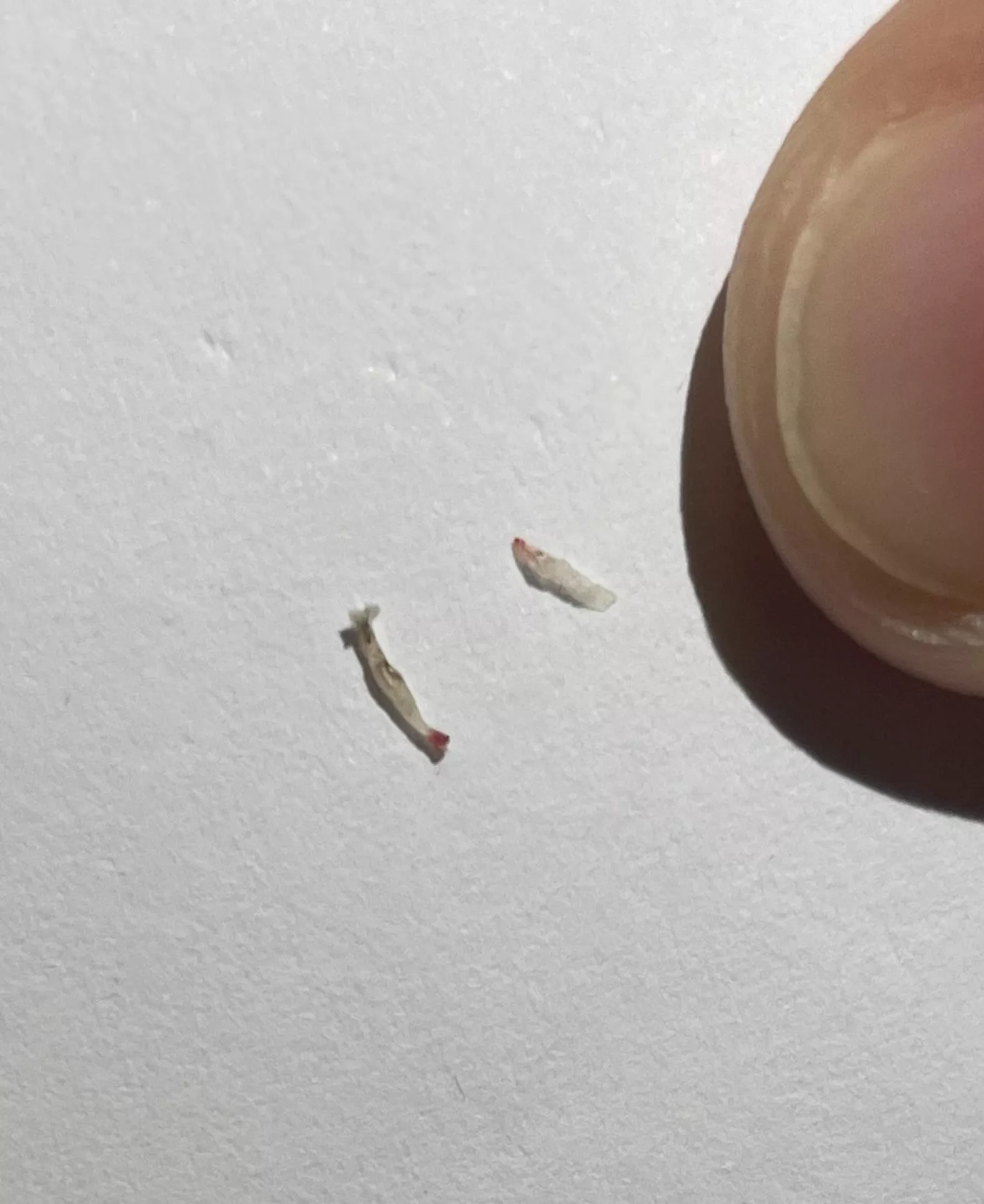 I tweezed something strange from my skin posted by ApprehensiveEgg7312