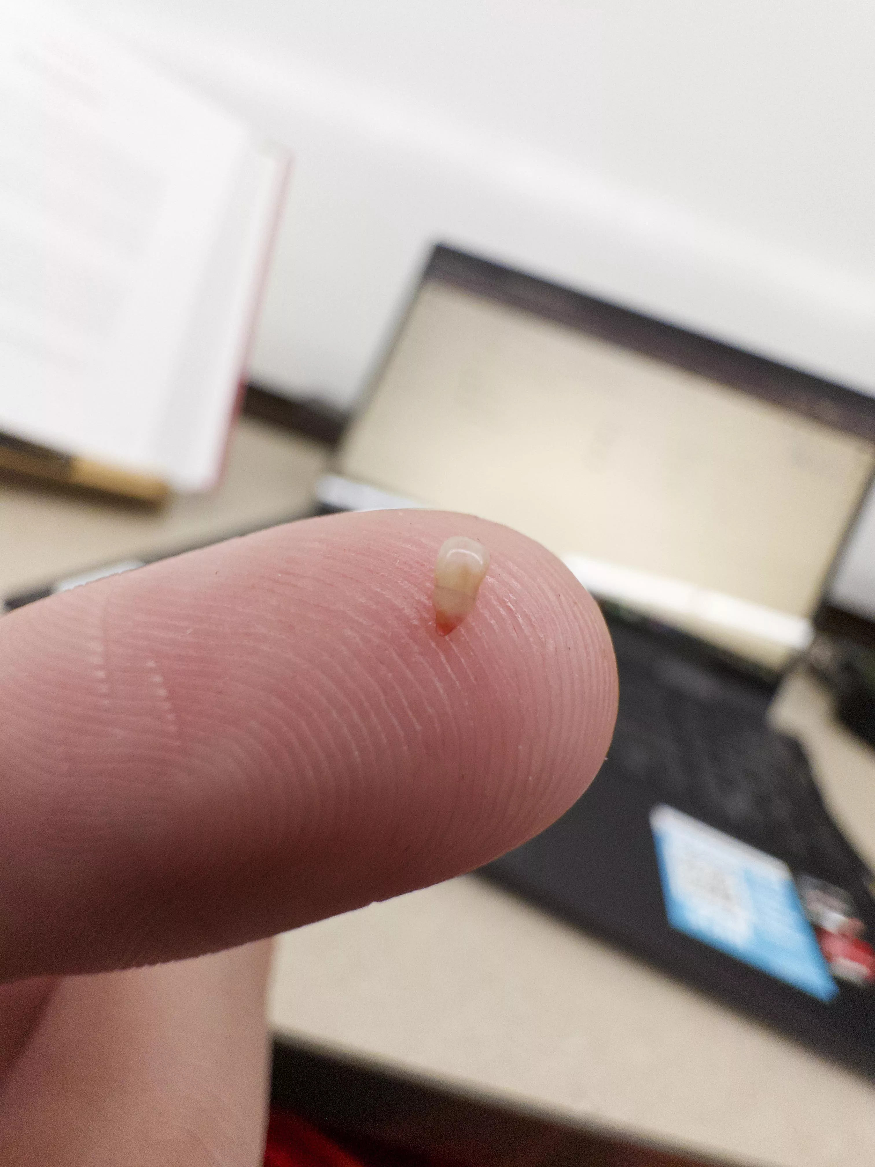 Just yoinked this little guy out of my back posted by CrispyHoneyBeef