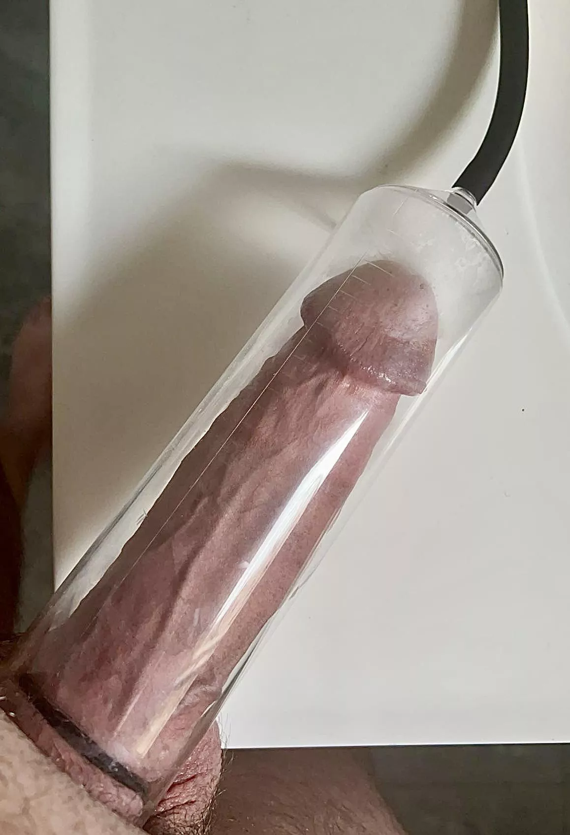 Ready to burst  posted by Outlawnurse